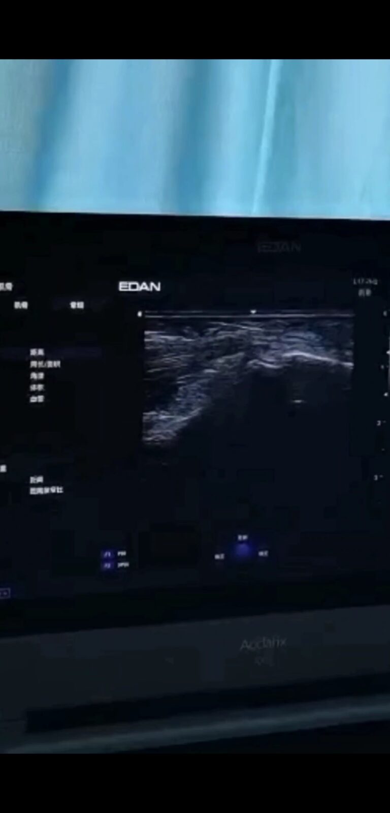 Screenshot_2021-06-13-20-22-30-599_com.miui.video