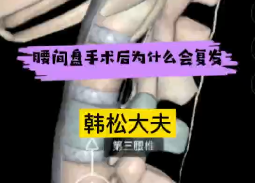 腰间盘术后为何复发？