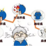 带状疱疹后神经痛
