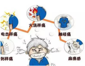 带状疱疹后神经痛