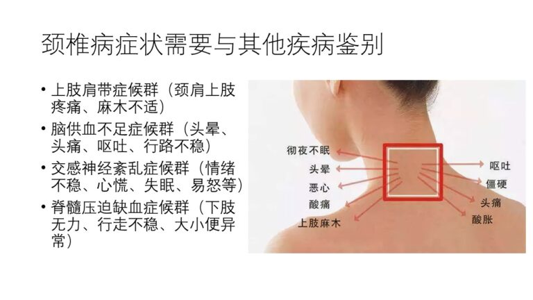 颈椎病的一些常见误区