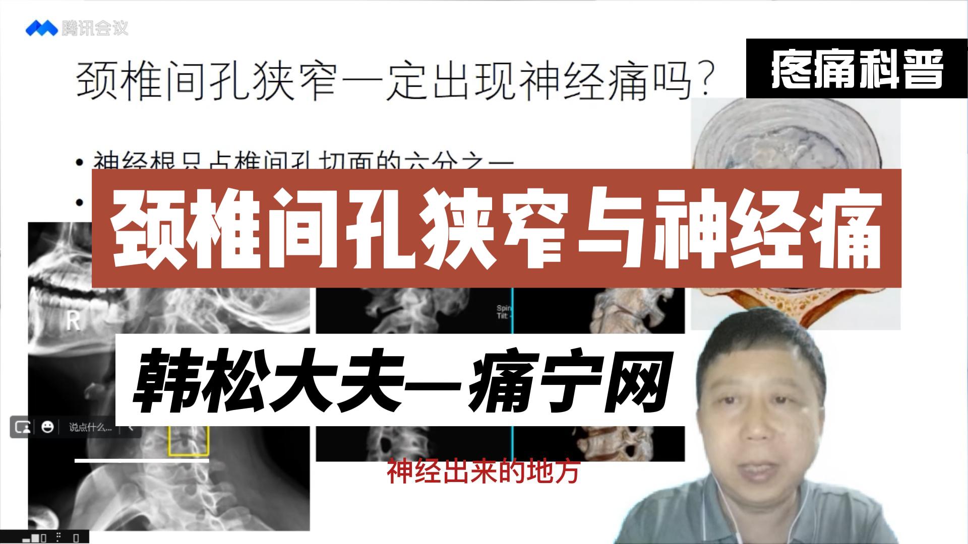 颈椎间孔狭窄与神经痛
