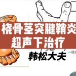 桡骨茎突腱鞘炎超声下治疗-封面