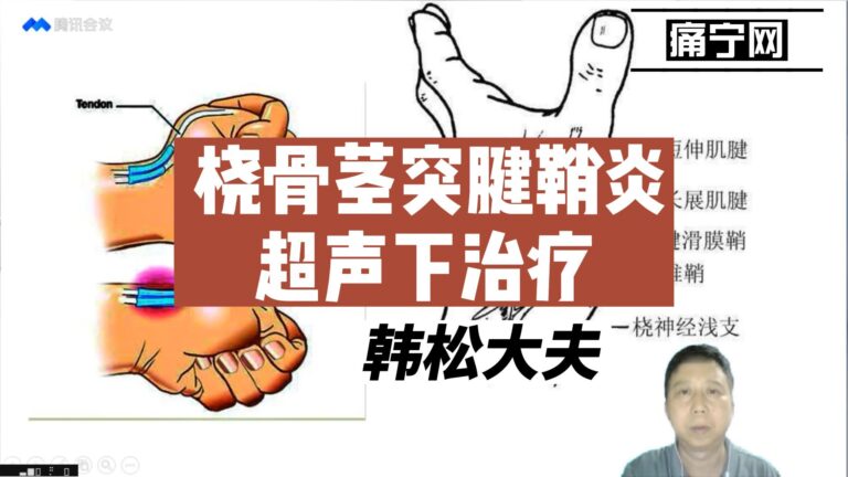 桡骨茎突腱鞘炎超声下治疗-封面