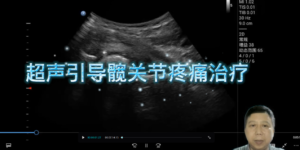 超声引导髋关节