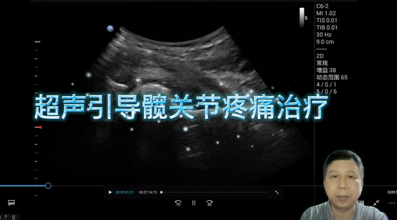 超声引导下髋关节疼痛治疗