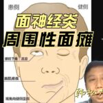 面神经炎