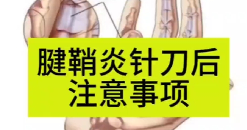 腱鞘炎行针刀操作后注意事项