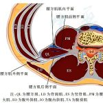 腰方肌阻滞