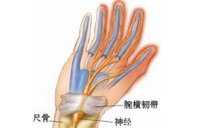 腕管腱鞘炎
