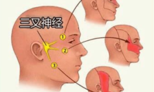 三叉神经分布-384x230