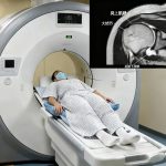 磁共振的肩关节检查