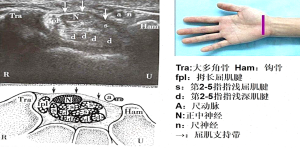 腕管解剖
