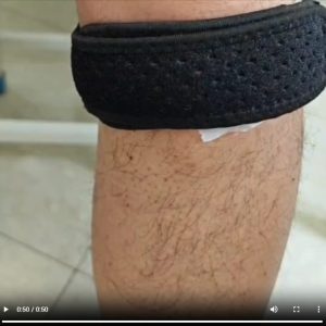 膝关节囊肿压迫带