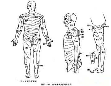 头面部与胸背部带状疱疹后神经痛区域
